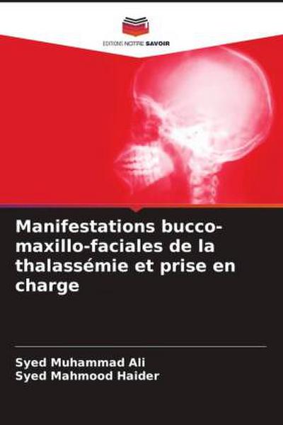 Manifestations bucco-maxillo-faciales de la thalassémie et prise en charge