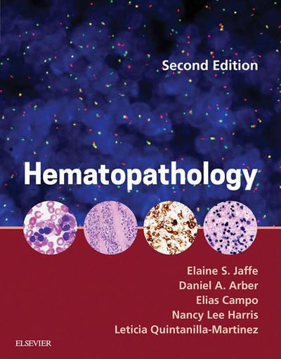 Hematopathology E-Book