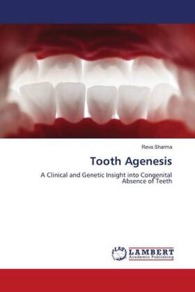 Tooth Agenesis