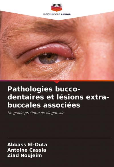 Pathologies bucco-dentaires et lésions extra-buccales associées
