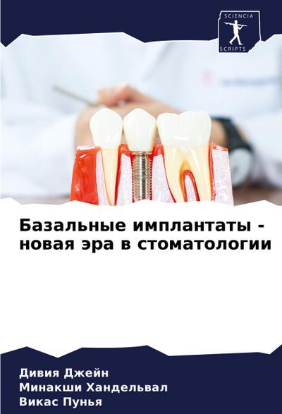 Bazal’nye implantaty - nowaq ära w stomatologii