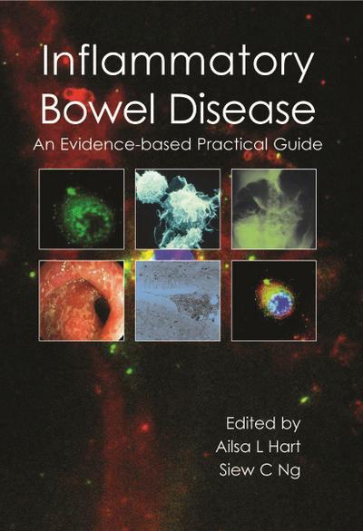 Inflammatory Bowel Disease: An Evidence-Based Practical Guide