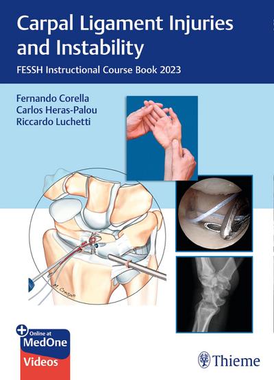 Carpal Ligament Injuries and Instability