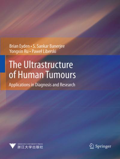 The Ultrastructure of Human Tumours