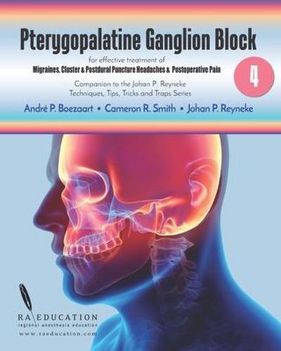 Johan P Reyneke’s Techniques, Tips, Tricks & Traps Vol 4: Pterygopalatine Ganglion Block