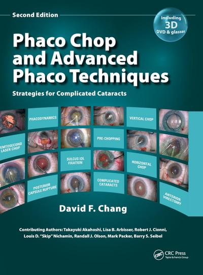 Phaco Chop and Advanced Phaco Techniques