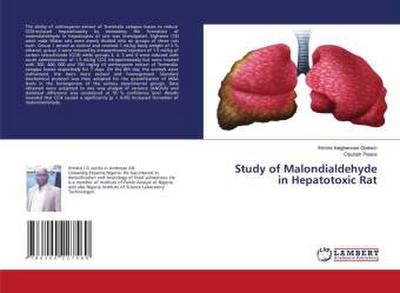 Study of Malondialdehyde in Hepatotoxic Rat
