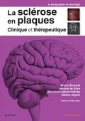 La sclerose en plaques - Clinique et therapeutique