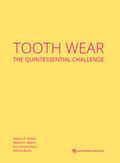 Tooth Wear