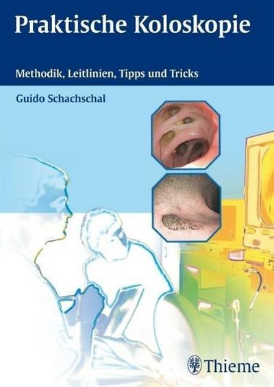 Praktische Koloskopie: Methodik, Leitlinien, Tipps und Tricks