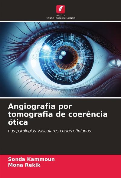 Angiografia por tomografia de coerência ótica