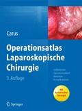 Operationsatlas Laparoskopische Chirurgie von Thomas Carus | Ebook