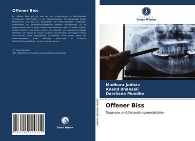 Offener Biss