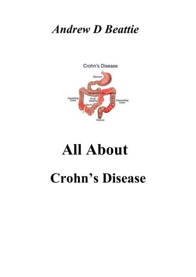 All About Crohn’s Disease