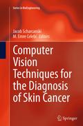 Computer Vision Techniques for the Diagnosis of Skin Cancer