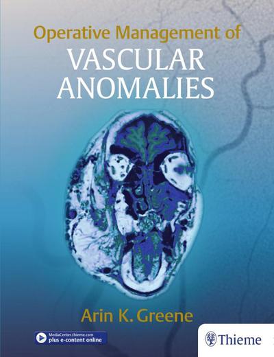 Operative Management of Vascular Anomalies