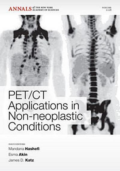 Pet CT Applications in Non-Neoplastic Conditions, Volume 1228