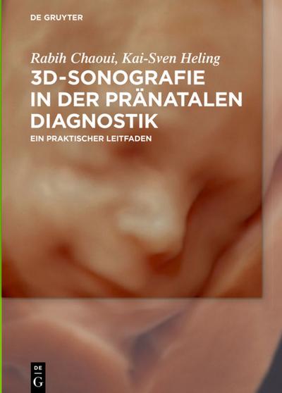 Chaoui, R: 3D-Sonografie in der pränatalen Diagnostik