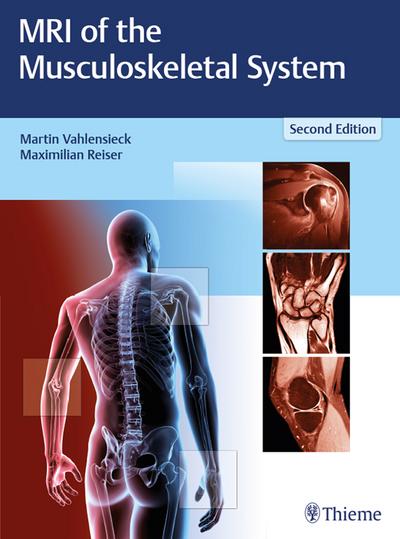 MRI of the Musculoskeletal System