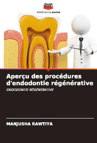 Aperçu des procédures d’endodontie régénérative