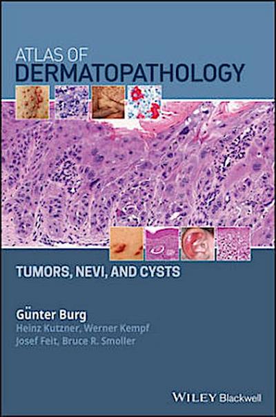 Atlas of Dermatopathology