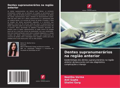 Dentes supranumerários na região anterior