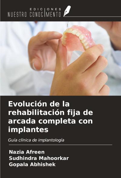 Evolución de la rehabilitación fija de arcada completa con implantes