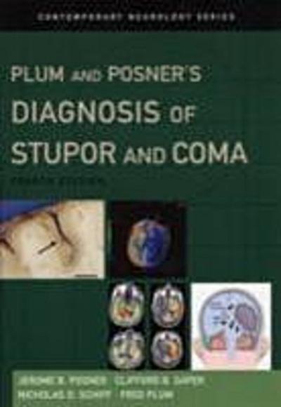 Plum and Posner’s Diagnosis of Stupor and Coma