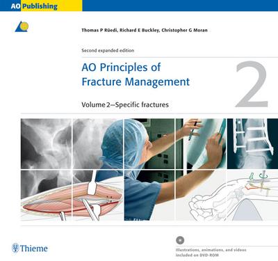 AO Principles of Fracture Management, Books and DVD