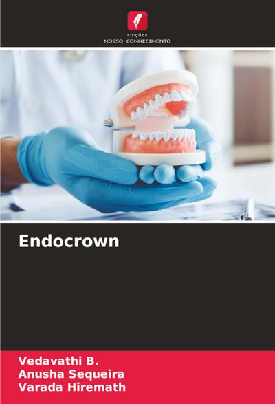 Endocrown