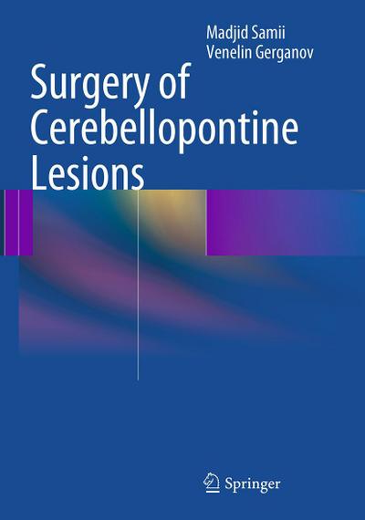 Surgery of Cerebellopontine Lesions