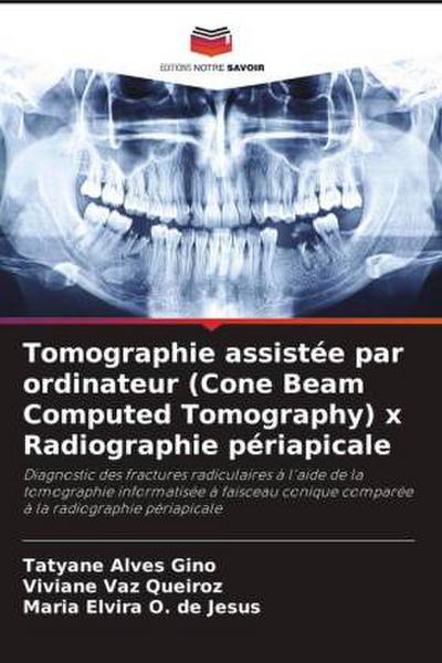 Tomographie assistée par ordinateur (Cone Beam Computed Tomography) x Radiographie périapicale