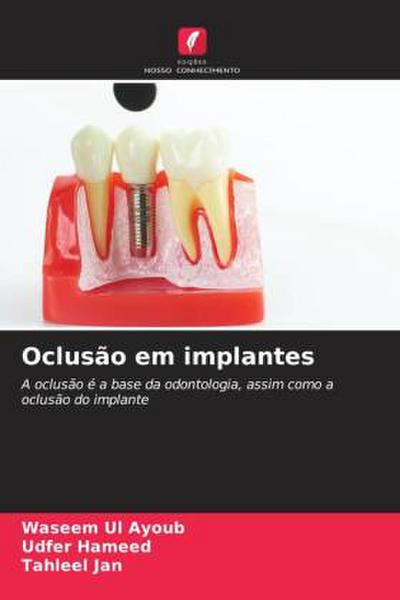 Oclusão em implantes