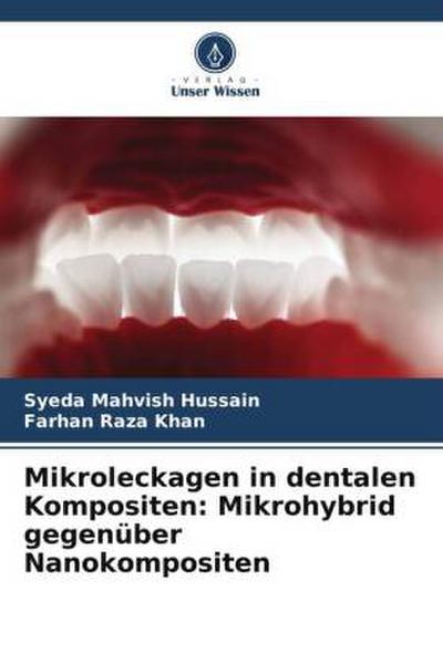 Mikroleckagen in dentalen Kompositen: Mikrohybrid gegenüber Nanokompositen
