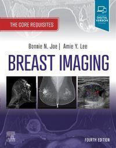 Breast Imaging