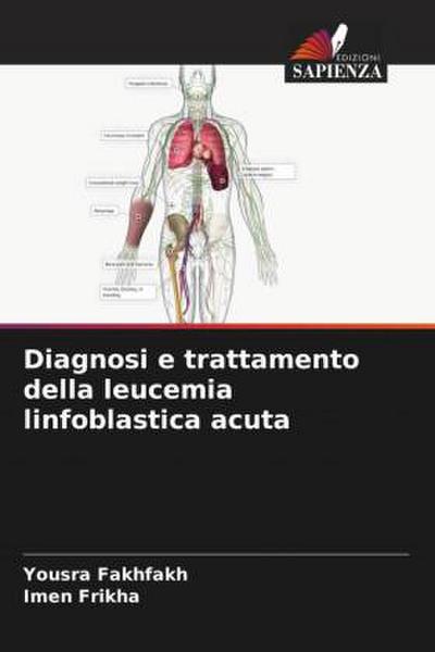 Diagnosi e trattamento della leucemia linfoblastica acuta