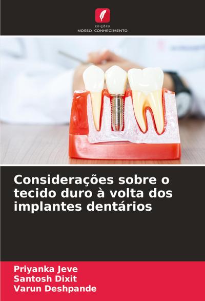 Considerações sobre o tecido duro à volta dos implantes dentários