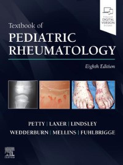 Textbook of Pediatric Rheumatology E-Book