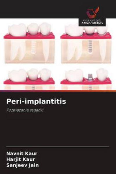 Peri-implantitis