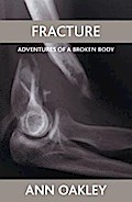 Fracture