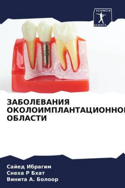 ZABOLEVANIYa OKOLOIMPLANTACIONNOJ OBLASTI