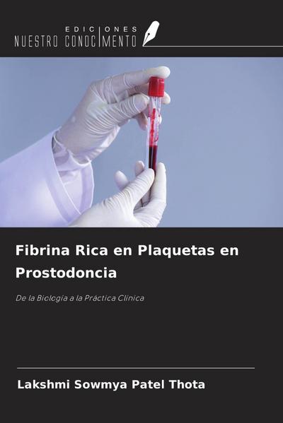 Fibrina Rica en Plaquetas en Prostodoncia