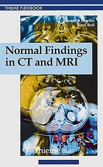 NORMAL FINDINGS IN CT & MRI