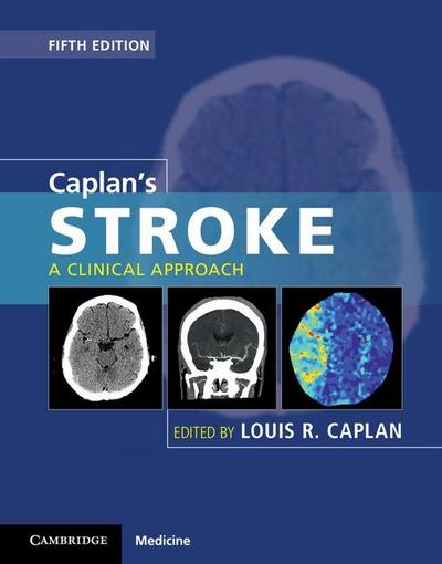 Caplan’s Stroke