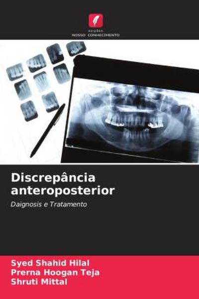 Discrepância anteroposterior