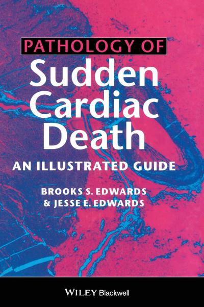 Pathology of Sudden Cardiac Death