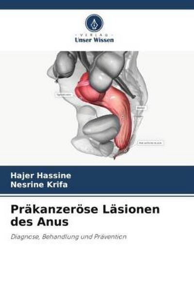 Präkanzeröse Läsionen des Anus