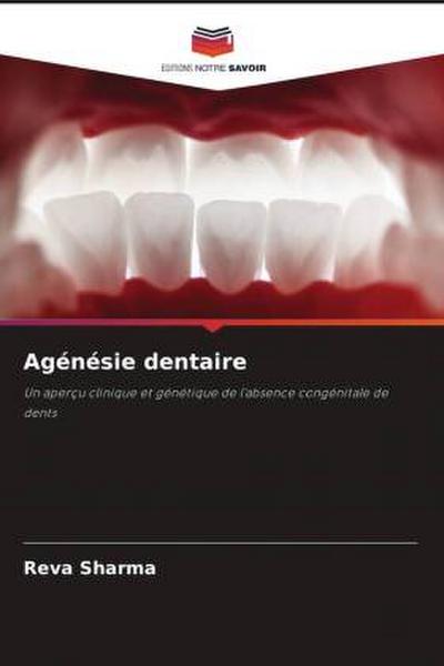 Agénésie dentaire