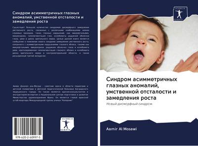 Sindrom asimmetrichnyh glaznyh anomalij, umstwennoj otstalosti i zamedleniq rosta