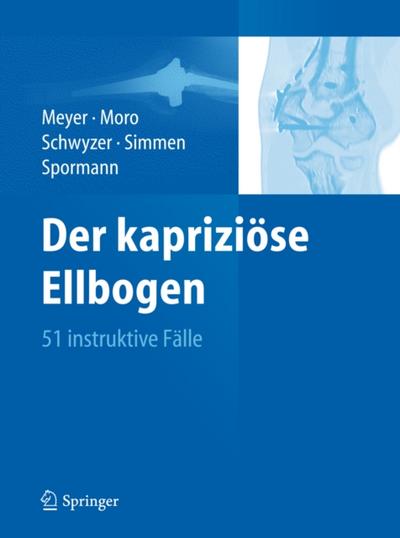 Der kapriziöse Ellbogen